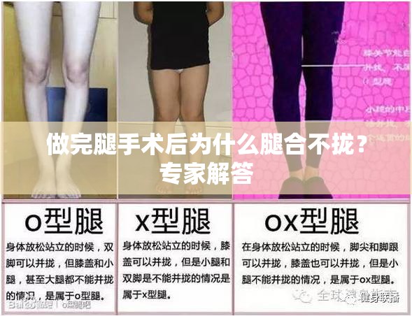 做完腿手术后为什么腿合不拢？专家解答