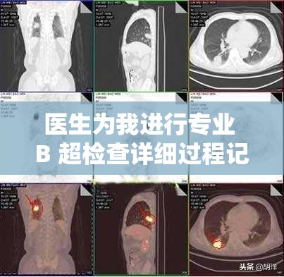 医生为我进行专业 B 超检查详细过程记录