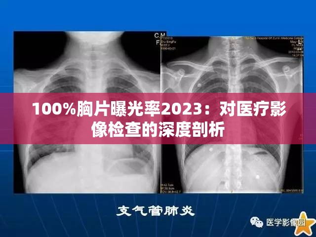 100%胸片曝光率2023：对医疗影像检查的深度剖析