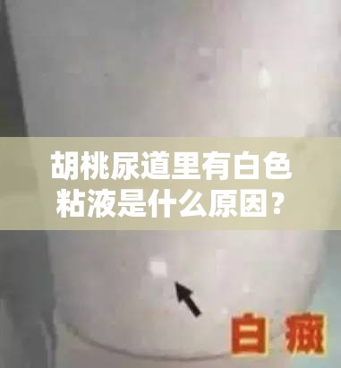 胡桃尿道里有白色粘液是什么原因？需警惕的常见健康问题解析